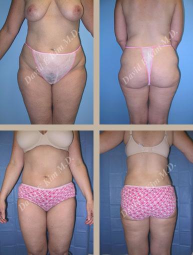 Beverly Hills Plastic Surgery gallery image 131