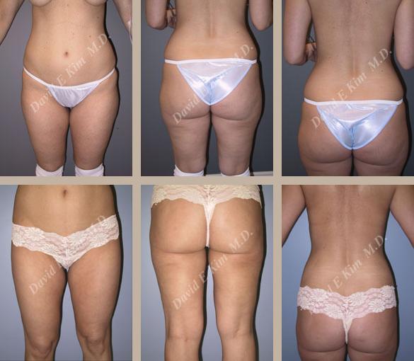 Beverly Hills Plastic Surgery gallery image 132