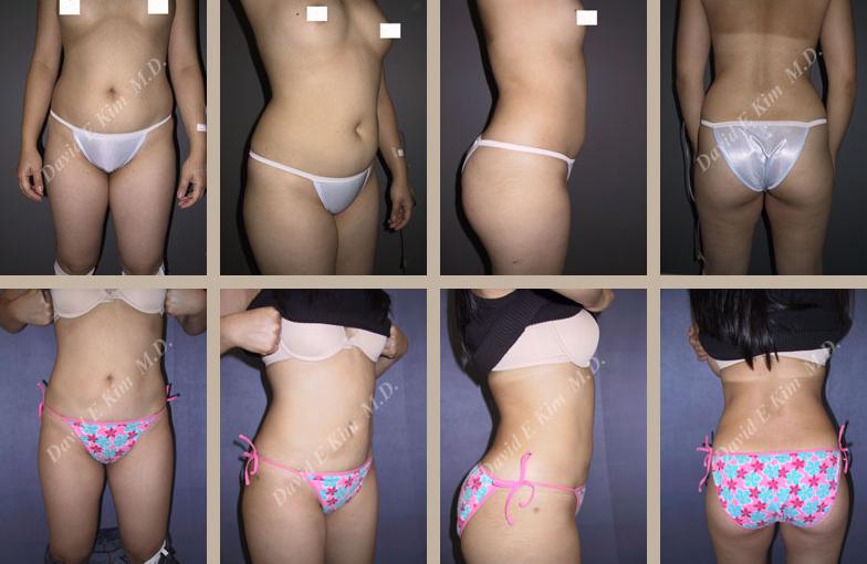 Beverly Hills Plastic Surgery gallery image 133
