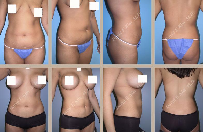 Beverly Hills Plastic Surgery gallery image 134