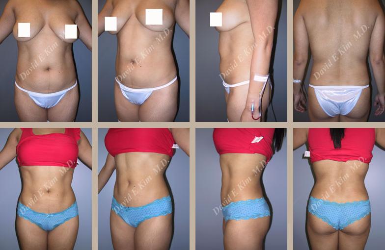 Beverly Hills Plastic Surgery gallery image 135