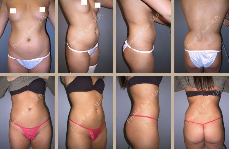 Beverly Hills Plastic Surgery gallery image 136