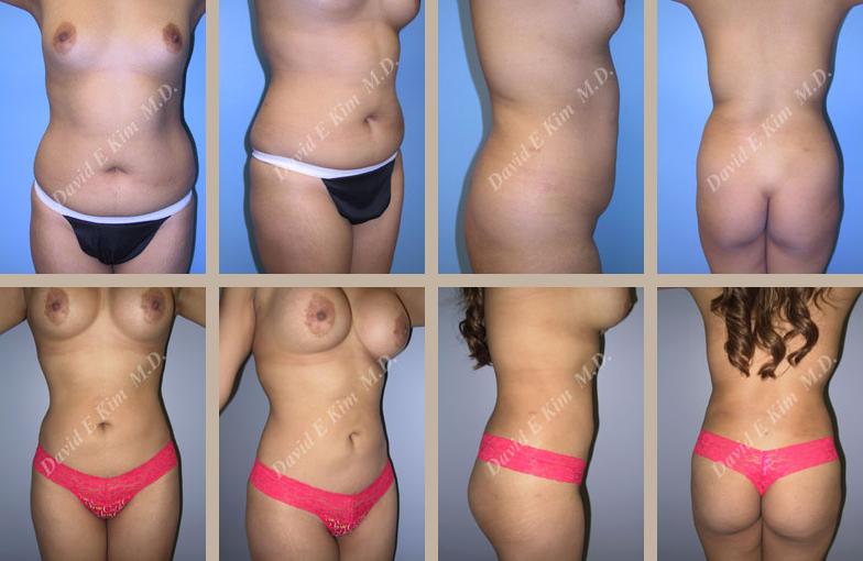 Beverly Hills Plastic Surgery gallery image 137