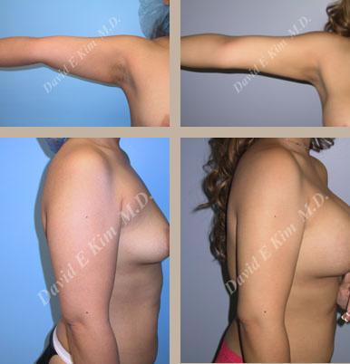 Beverly Hills Plastic Surgery gallery image 138
