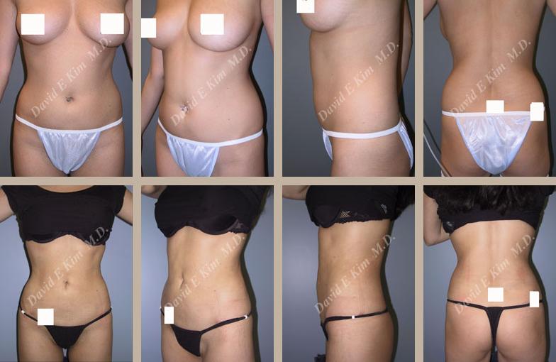 Beverly Hills Plastic Surgery gallery image 139
