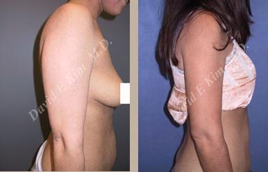 Beverly Hills Plastic Surgery gallery image 140