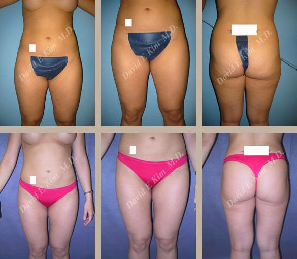 Beverly Hills Plastic Surgery gallery image 141