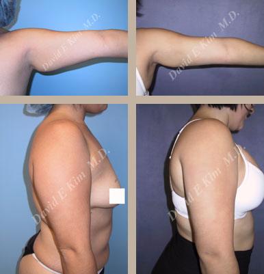 Beverly Hills Plastic Surgery gallery image 142