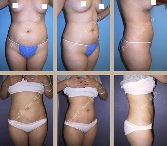 Beverly Hills Plastic Surgery gallery image 144