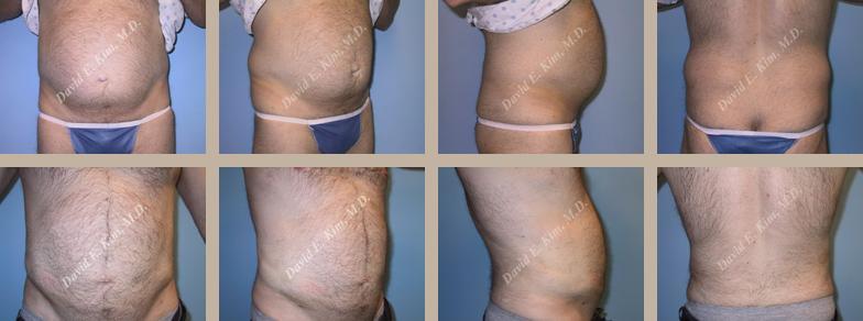 Beverly Hills Plastic Surgery gallery image 145