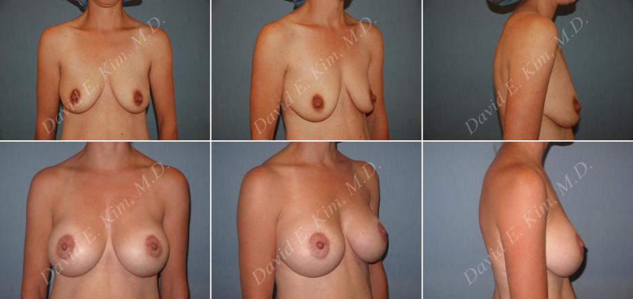 Beverly Hills Plastic Surgery gallery image 147