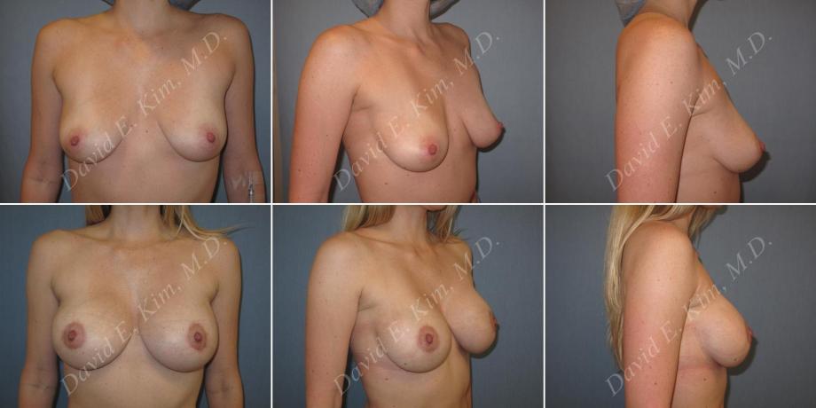 Beverly Hills Plastic Surgery gallery image 148