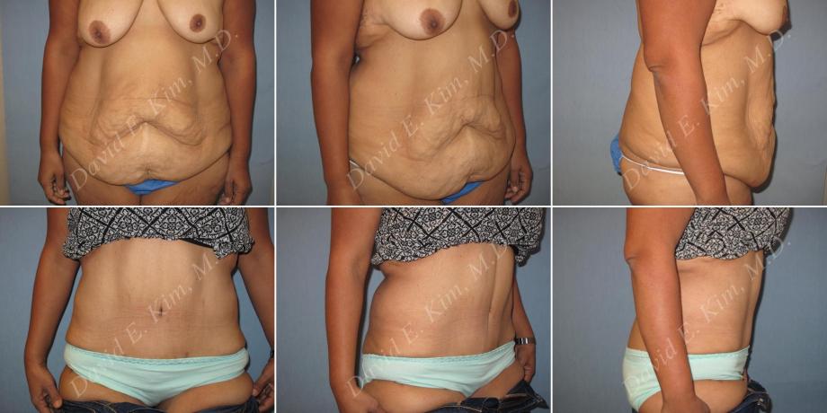 Beverly Hills Plastic Surgery gallery image 149