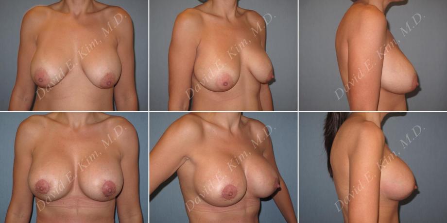 Beverly Hills Plastic Surgery gallery image 150