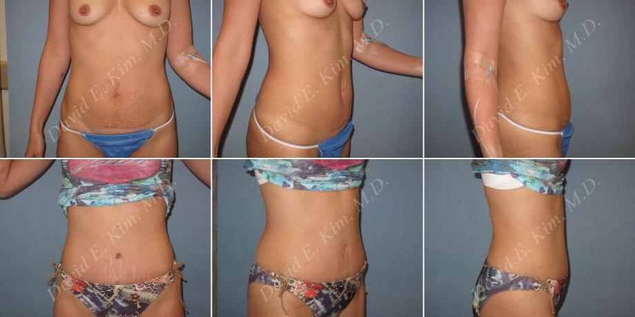 Beverly Hills Plastic Surgery gallery image 152