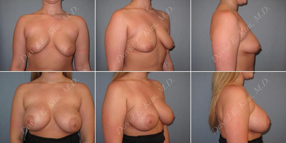 Beverly Hills Plastic Surgery gallery image 153