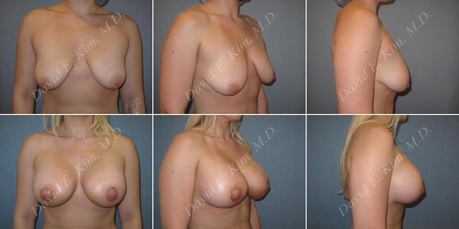 Beverly Hills Plastic Surgery gallery image 154