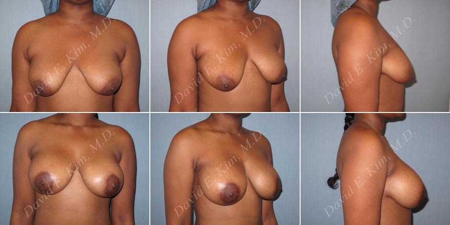 Beverly Hills Plastic Surgery gallery image 155