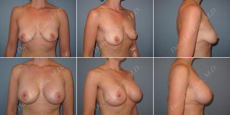 Beverly Hills Plastic Surgery gallery image 156