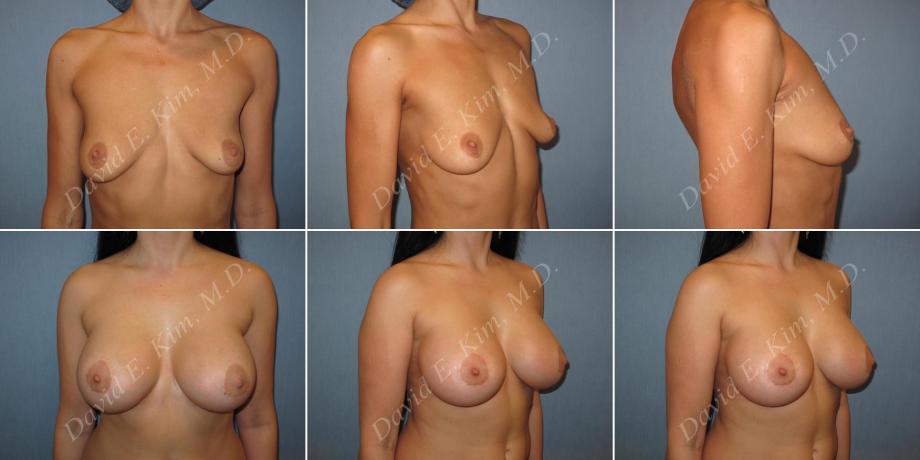 Beverly Hills Plastic Surgery gallery image 158
