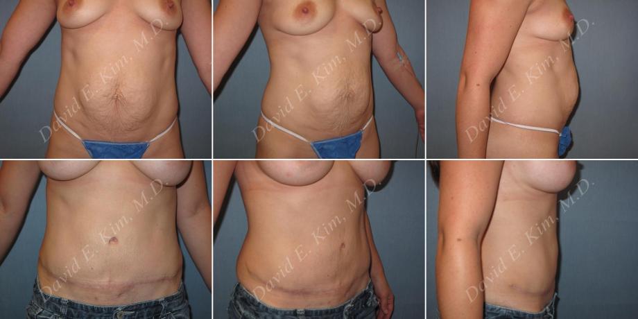 Beverly Hills Plastic Surgery gallery image 159