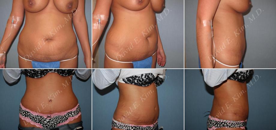 Beverly Hills Plastic Surgery gallery image 160
