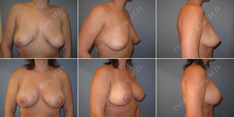 Beverly Hills Plastic Surgery gallery image 161