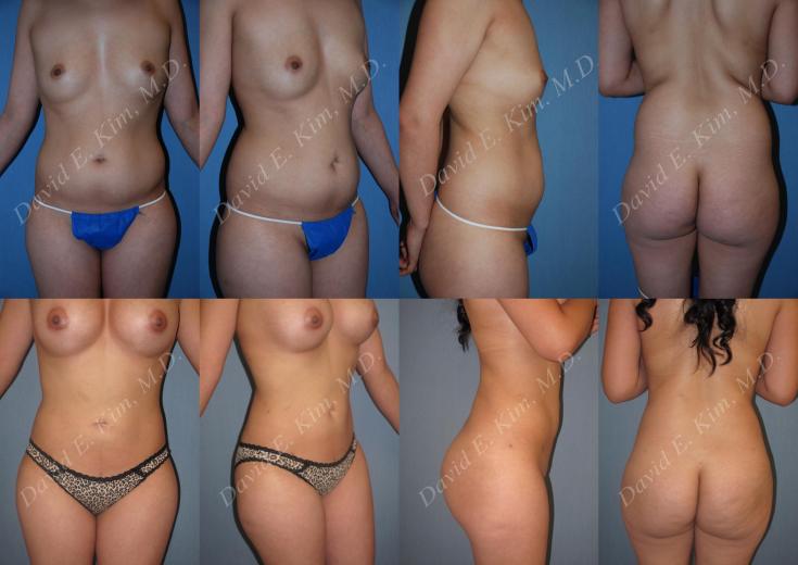 Beverly Hills Plastic Surgery gallery image 162