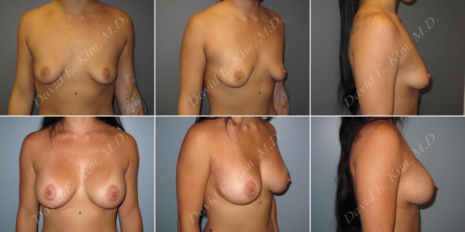 Beverly Hills Plastic Surgery gallery image 163
