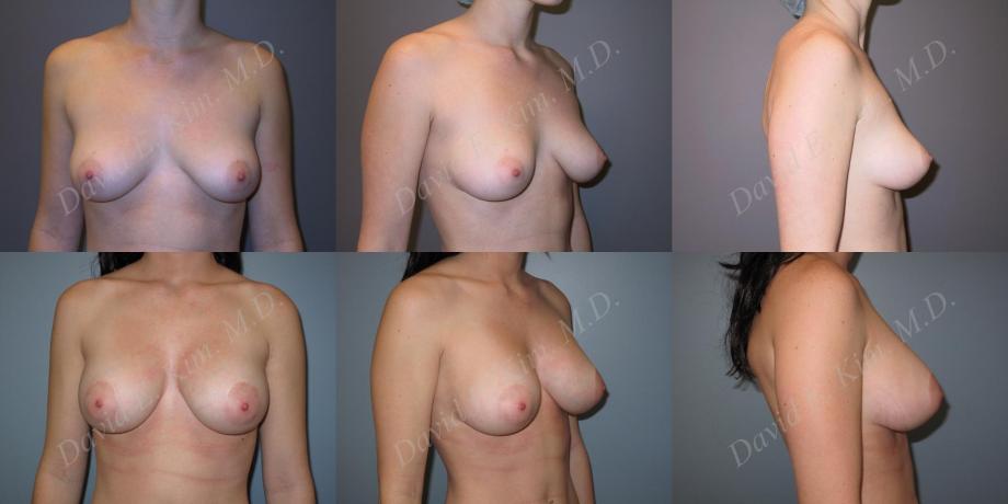 Beverly Hills Plastic Surgery gallery image 165