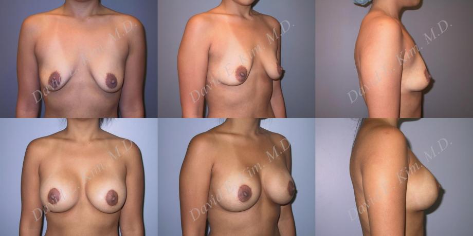Beverly Hills Plastic Surgery gallery image 166