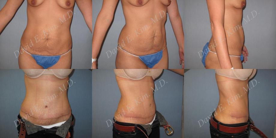 Beverly Hills Plastic Surgery gallery image 167