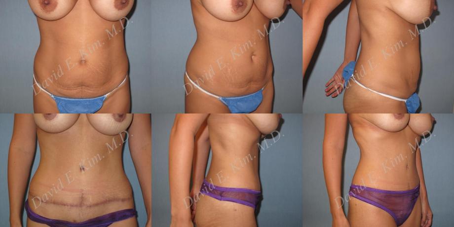 Beverly Hills Plastic Surgery gallery image 168