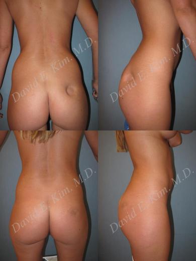 Beverly Hills Plastic Surgery gallery image 169
