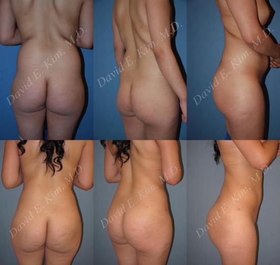 Beverly Hills Plastic Surgery gallery image 170