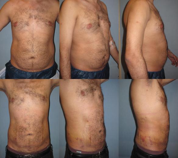 Beverly Hills Plastic Surgery gallery image 173