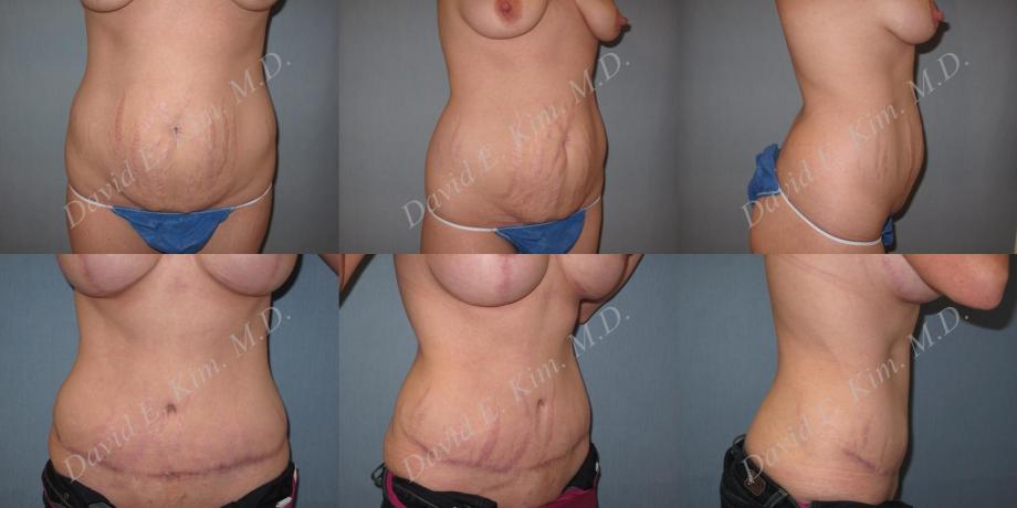 Beverly Hills Plastic Surgery gallery image 183
