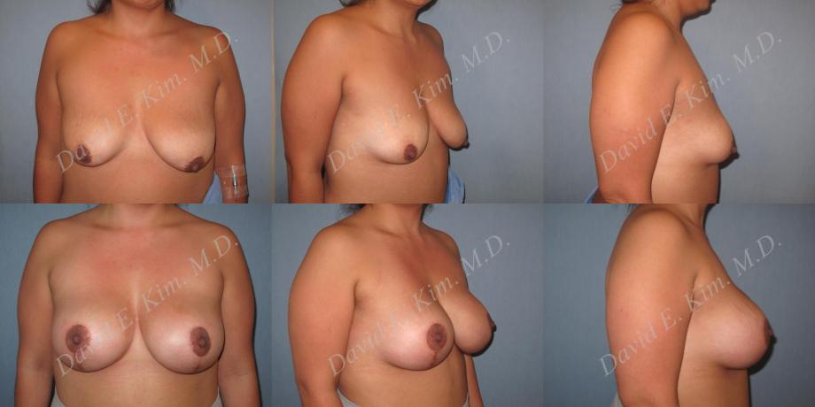Beverly Hills Plastic Surgery gallery image 184