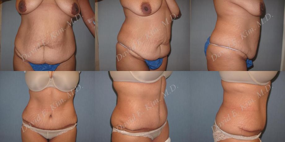 Beverly Hills Plastic Surgery gallery image 188