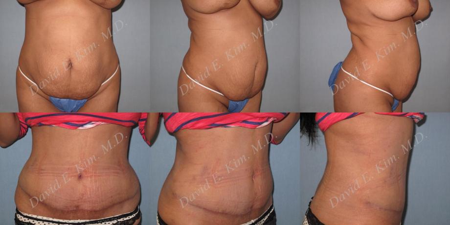 Beverly Hills Plastic Surgery gallery image 191