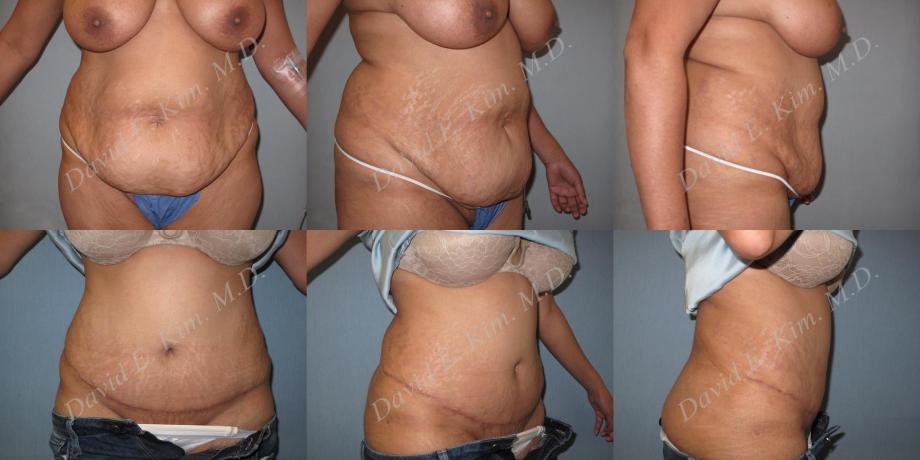 Beverly Hills Plastic Surgery gallery image 194
