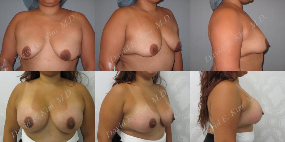 Beverly Hills Plastic Surgery gallery image 195