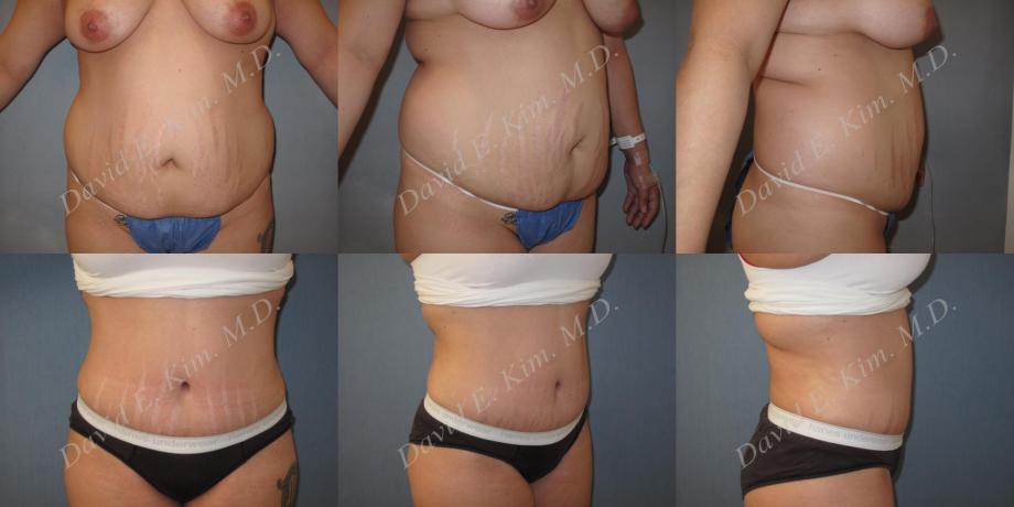 Beverly Hills Plastic Surgery gallery image 197