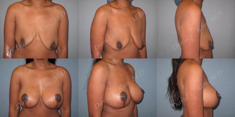 Beverly Hills Plastic Surgery gallery image 200