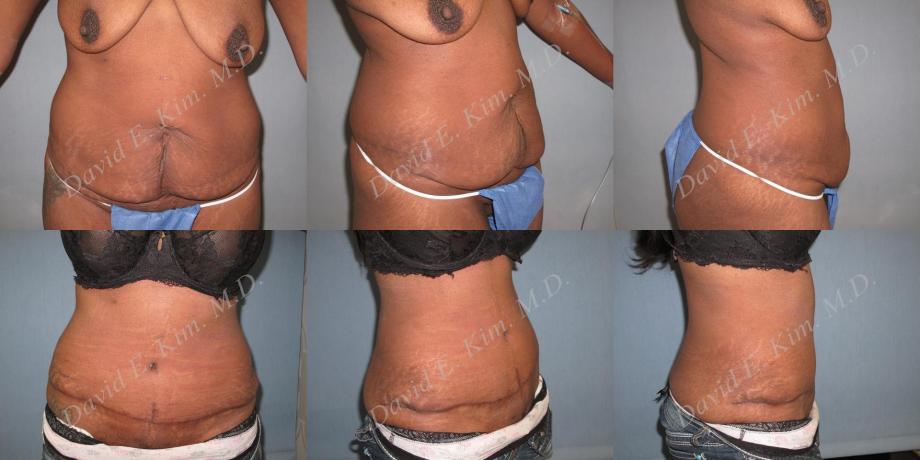 Beverly Hills Plastic Surgery gallery image 201