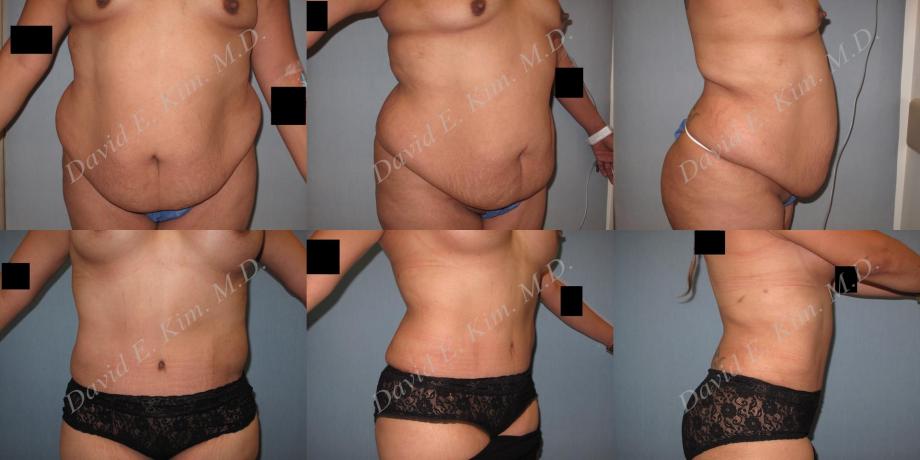 Beverly Hills Plastic Surgery gallery image 203