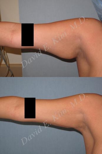 Beverly Hills Plastic Surgery gallery image 204