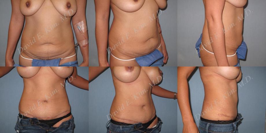 Beverly Hills Plastic Surgery gallery image 206