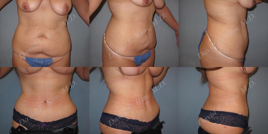 Beverly Hills Plastic Surgery gallery image 209