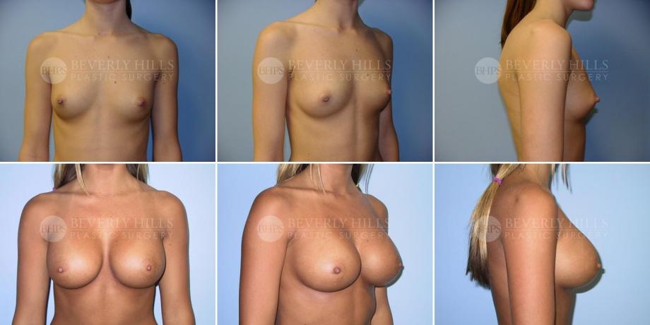 Beverly Hills Plastic Surgery gallery image 211
